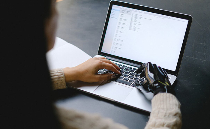 Person with a prosthetic hand working on a laptop